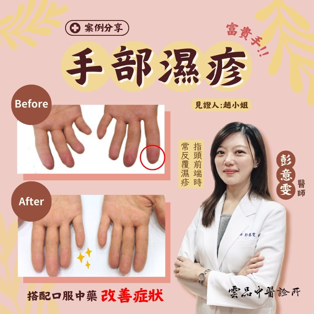 241004__skin_hands_eczema_case_dr.yiwen_cmed_yunpin