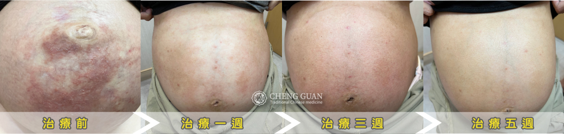 圖八-吳醫師癢疹吳珮瑧_400X400