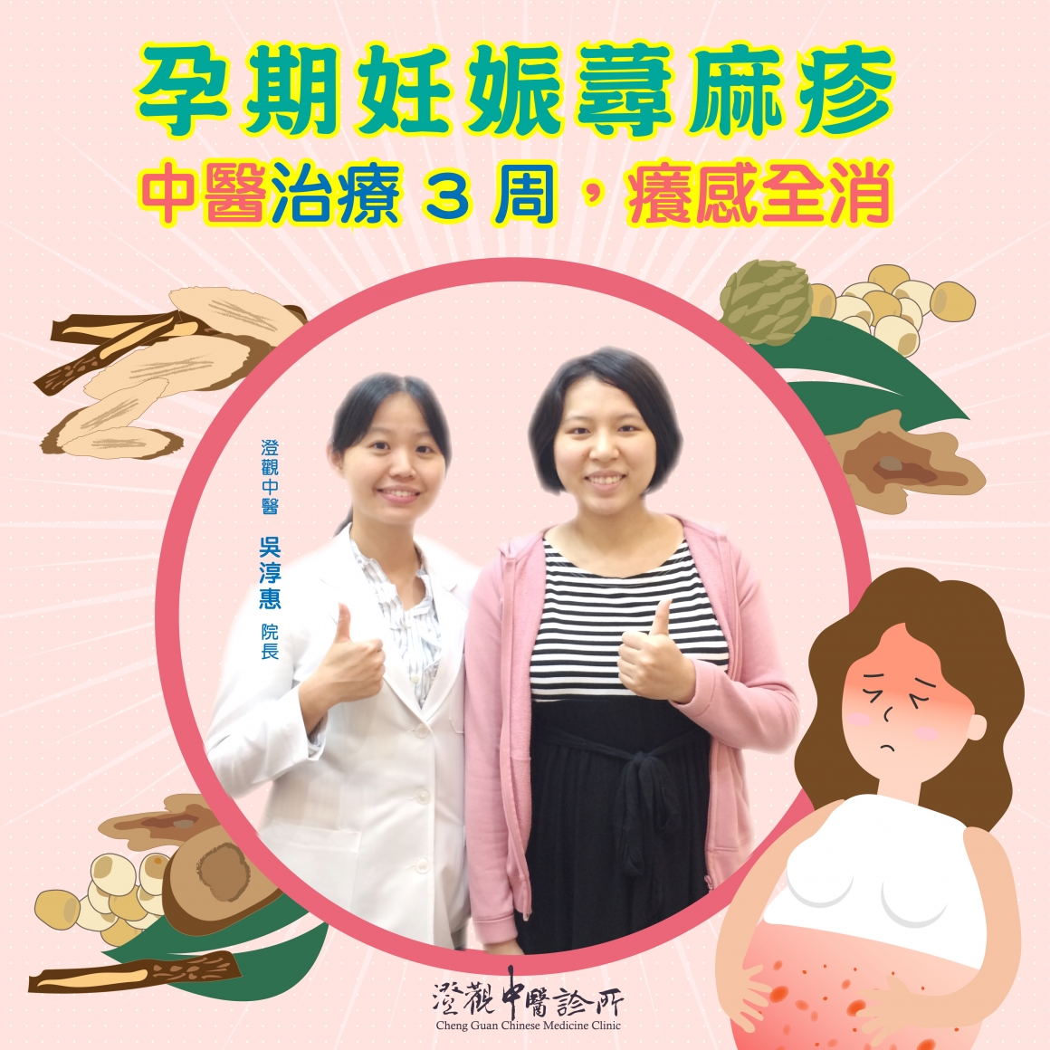 孕期妊娠蕁麻疹-01