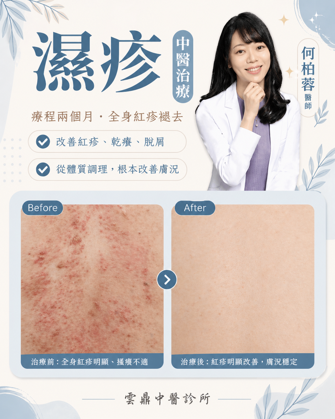 eczema_TCM_dr.ho_case