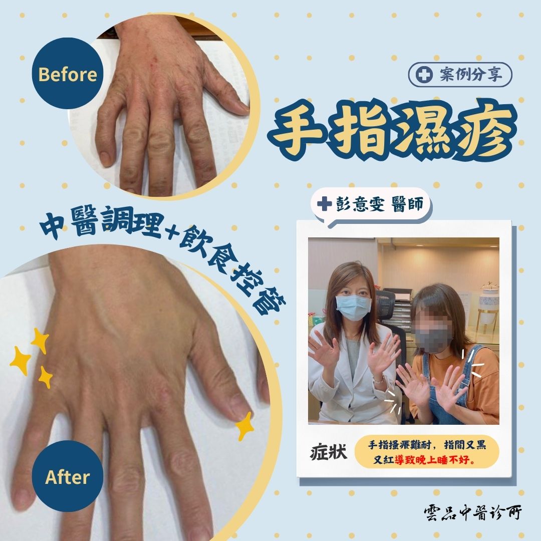 241217_skin_hands_eczema_case_dr.yiwen_cmed_yunpin_1