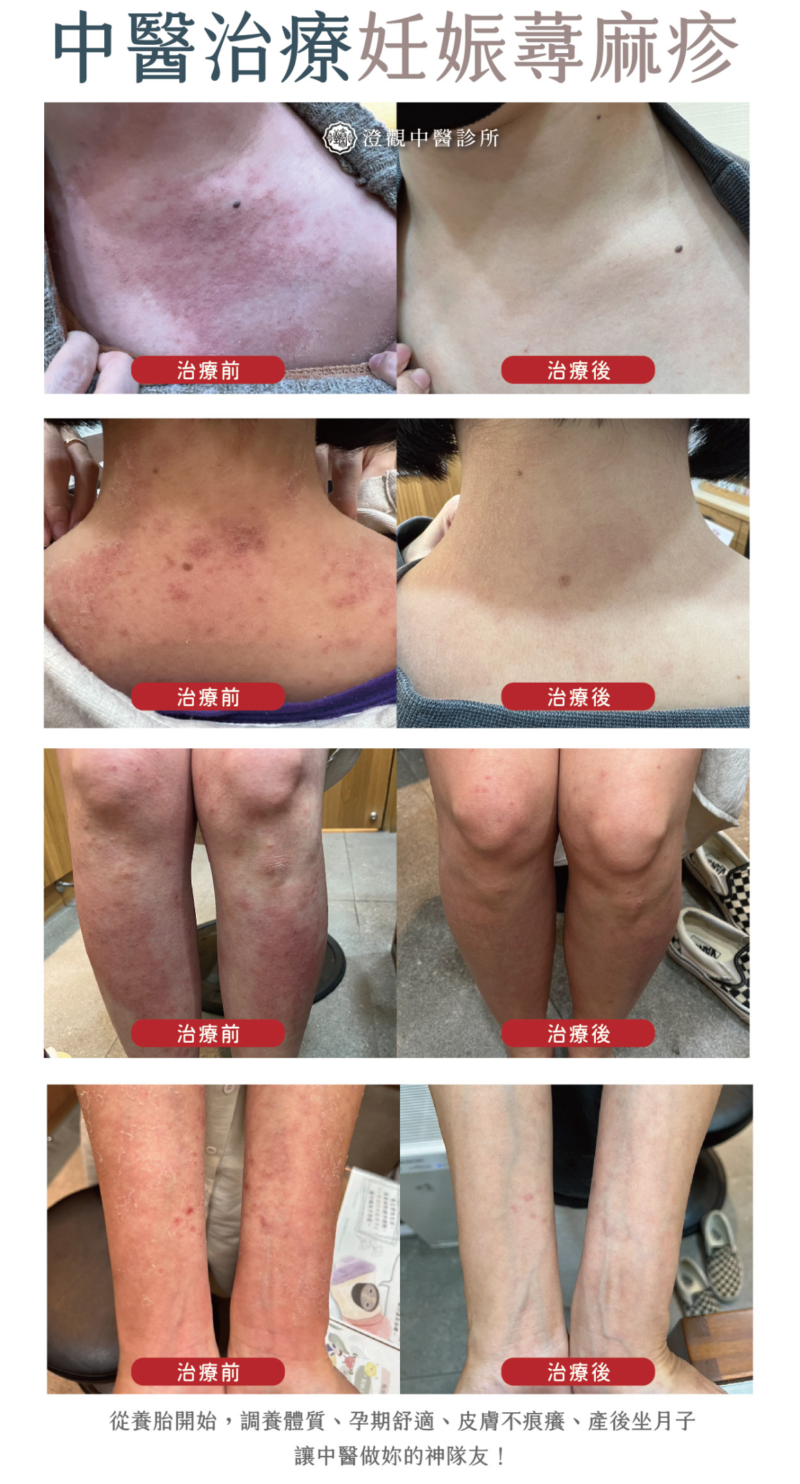 圖九十-妊娠(吳) 正方形拆成四張26-01