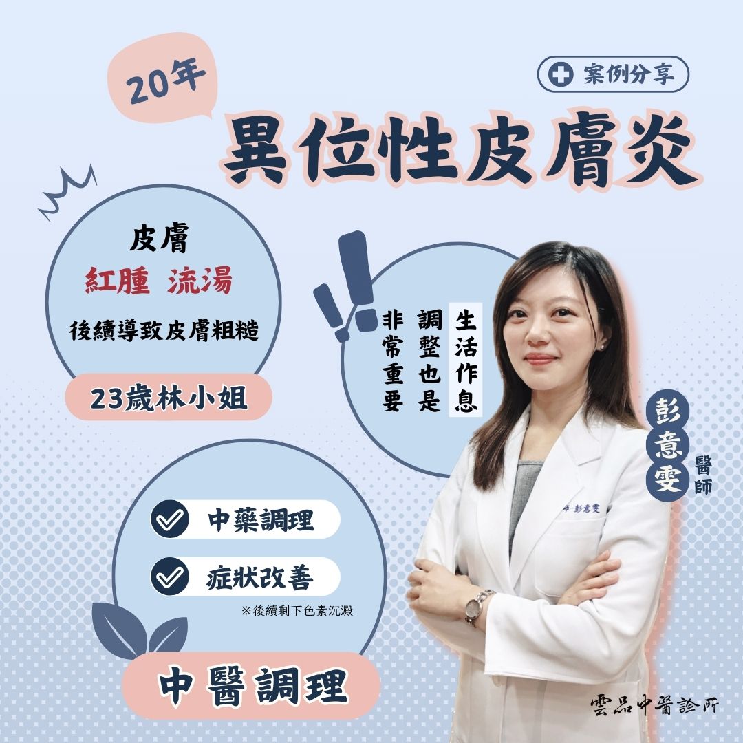 atopic dermatitis_case_dr.yiwen_cmed_yunpin atopic dermatitis_case_dr.yiwen_cmed_yunpin