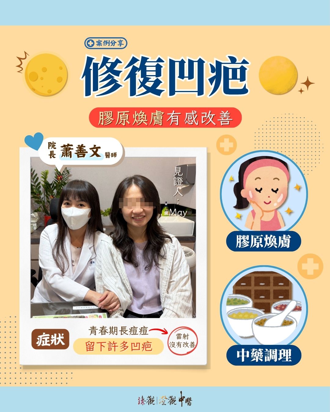 250729_atrophic scar_case_dr.Hsiao