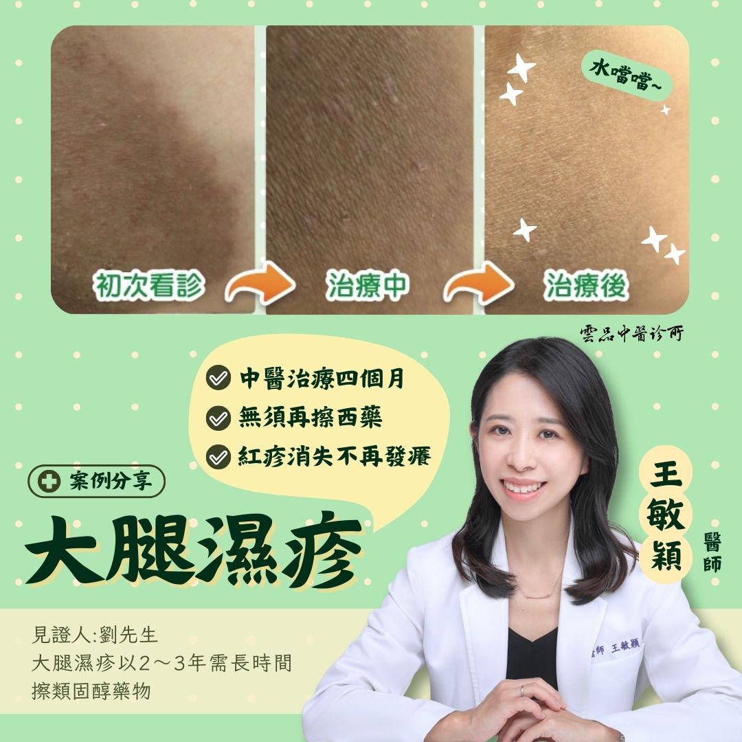 skin_thigh_eczema_case_dr.minyin_cmed_case
