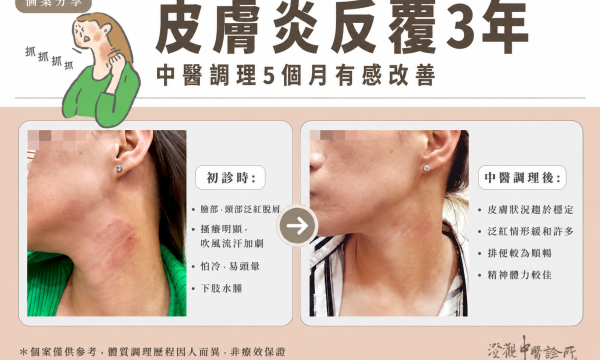 中醫治療濕疹 ｜澄觀中醫精誠院 廖婉菁醫師