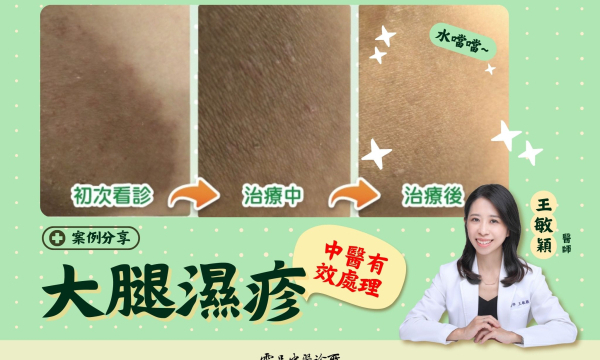 【大腿濕疹_劉先生】案例分享｜雲品中醫 王敏穎 醫師