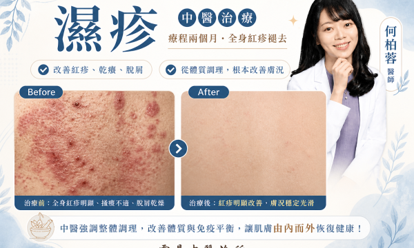 【濕疹中醫調理_陳小姐】案例分享｜雲鼎中醫 何柏蓉醫師