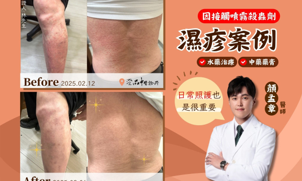 【腿部、背部大面積濕疹_林先生】案例分享｜澄品中醫 顏孟章 醫師