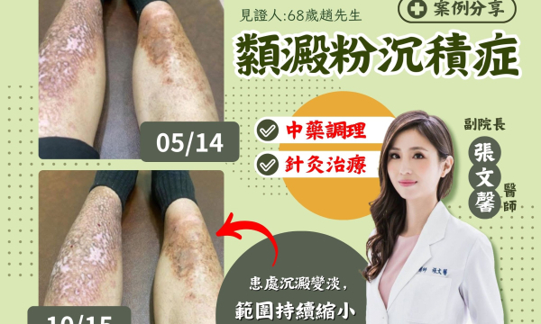 【類澱粉沉積症_趙先生】案例分享｜澄觀(台北)副院長 張文馨醫師