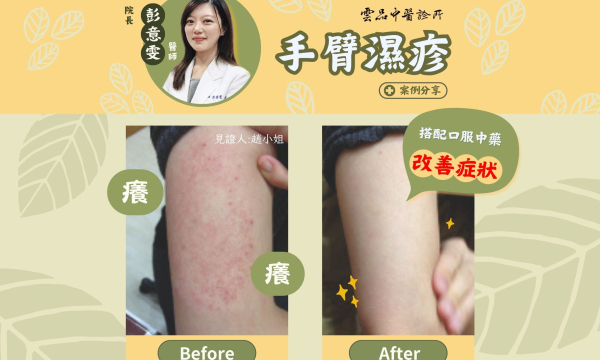 【上臂濕疹_趙小姐】案例分享｜雲品中醫 院長彭意雯 醫師