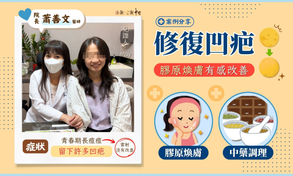 【凹疤治療_袁小姐】 案例分享|澄觀(台北)院長 蕭善文醫師