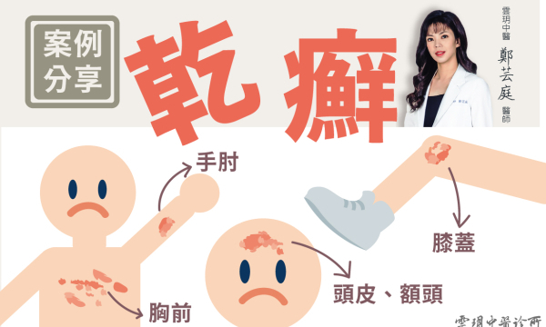 乾癬│皮膚專科│ 澄觀中醫（台中）鄭芸庭醫師
